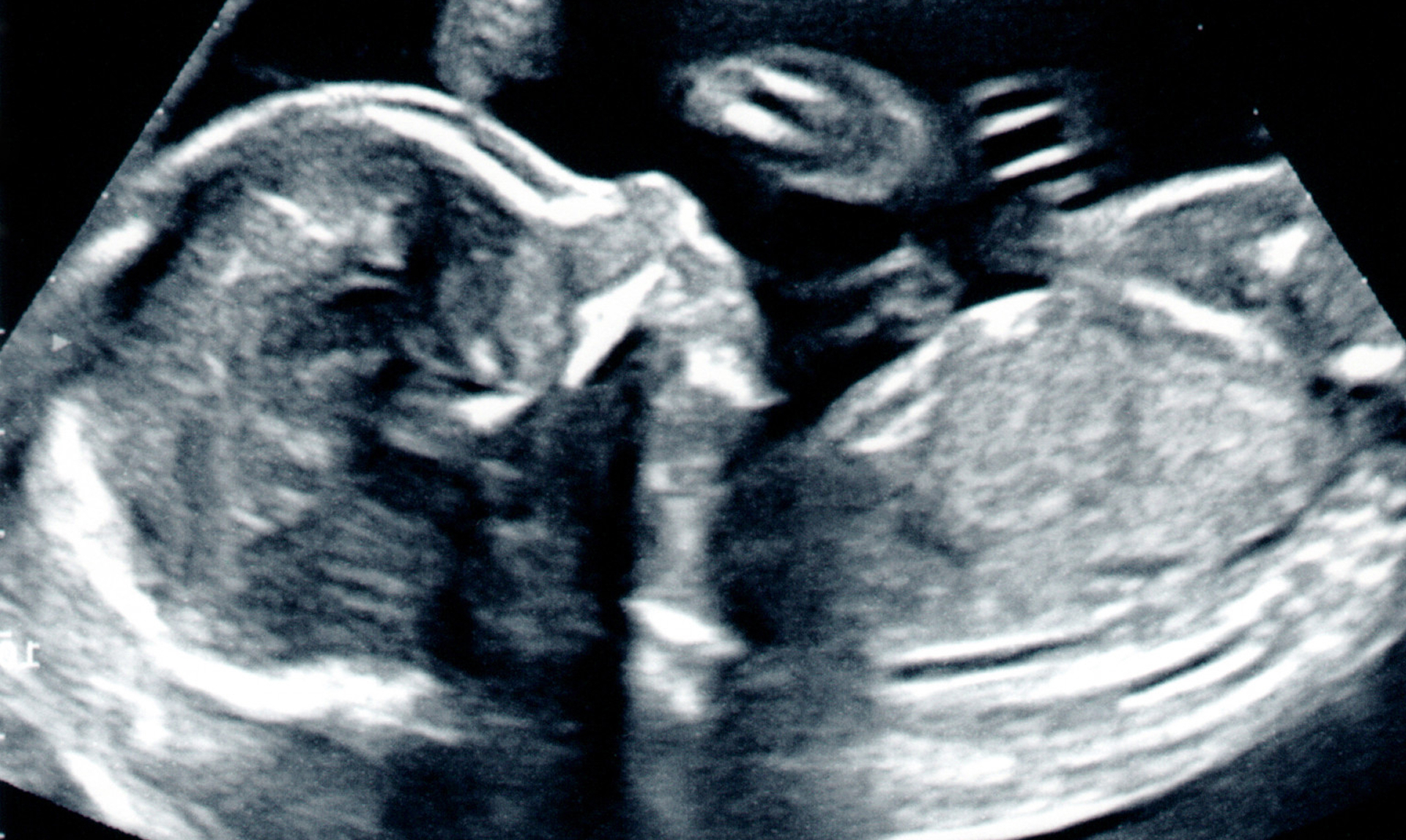 thirty-six-week-pregnancy-care-package