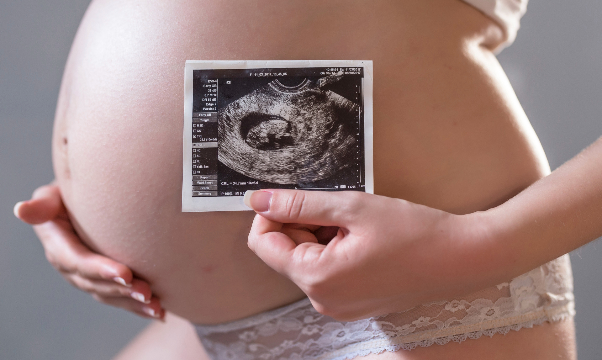 thirty-two-week-pregnancy-care-package