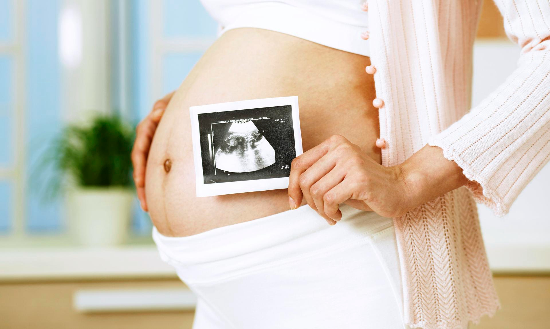 twenty-week-pregnancy-care-package